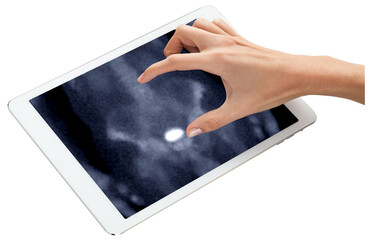 Hand interacting with tablet displaying PET/CT scans. Multiview diagnostic imaging highlights abnormal metabolic activity. Ideal for medical, oncology, and tech-related visuals.