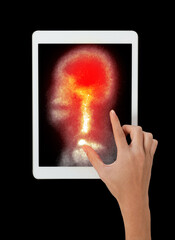 Hand interacting with tablet displaying PET/CT scans. Multiview diagnostic imaging highlights abnormal metabolic activity. Ideal for medical, oncology, and tech-related visuals.
