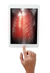 Hand interacting with tablet displaying PET/CT scans. Multiview diagnostic imaging highlights abnormal metabolic activity. Ideal for medical, oncology, and tech-related visuals.