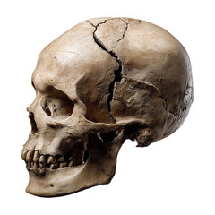 Fototapeta premium Human skull anatomy study side view with cracks and damage for medical reference and halloween decor