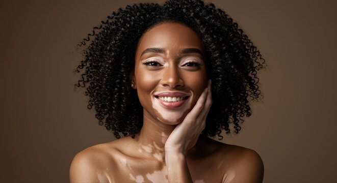 young confident woman with vitiligo smiling against a warm brown background