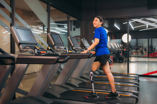 A motivated woman with a prosthetic leg walking on a treadmill in a modern gym, representing fitness, rehabilitation, and strength with a positive attitude towards an active healthy lifestyle.