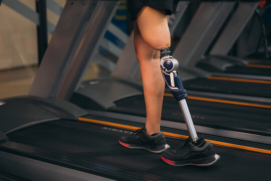 A motivated woman with a prosthetic leg walking on a treadmill in a modern gym, representing fitness, rehabilitation, and strength with a positive attitude towards an active healthy lifestyle.