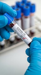 A lab technician holds a test tube with a blood sample that has tested positive for COVID-19. A clinical concept for the coronavirus pandemic, medical diagnosis, and research.