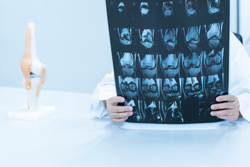 Doctor holding patient bone x-ray film before surgery.Image MRI and CT scan at radiology orthopedic department in hospital.Knee joint and ligament injury for treatment.Athlete injured concept.