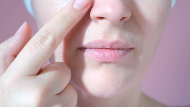 Young woman applying transparent round sticker to pimple on her face close-up on pink background.