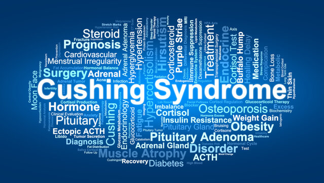 Cushing Syndrome Word Cloud. Composition Of Medical Terms Related To Cortisol Excess, Adrenal Dysfunction, Symptoms, Diagnosis, And Treatment Strategies In Endocrinology.