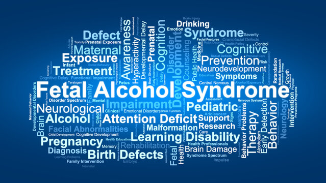 Fetal Alcohol Syndrome Word Cloud. Concepts Related To Prenatal Alcohol Exposure, Birth Defects, Brain Damage, Cognitive Impairment, And Developmental Disorders In Children.