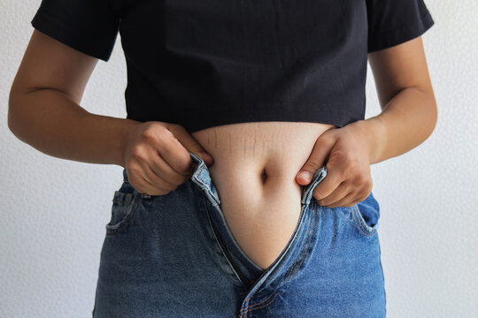 A woman in a black t-shirt and blue jeans trying to pull up her pants, showing stretch marks on her belly. Concept of body changes, postpartum recovery, skin care, and self-acceptance - Powered by Adobe