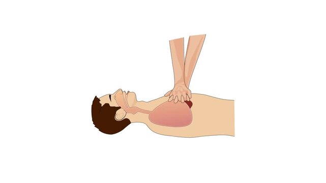 2D animation of CPR chest compressions showing medical resuscitation technique for training, safety, and emergency education