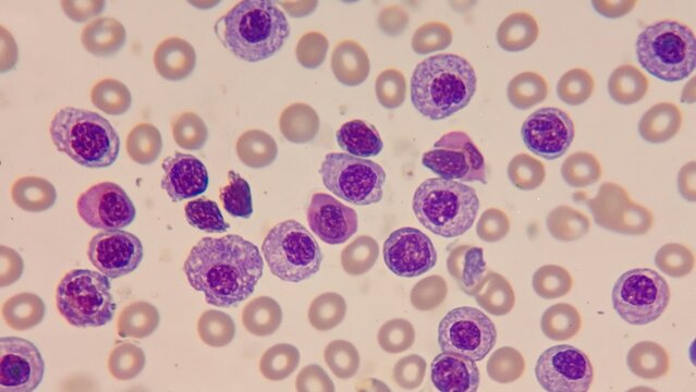 Microscopic view of human blood cells showing purple-stained white blood cells among red blood cells, representing hematology, medical research, laboratory diagnostics, biology, and cellular structure