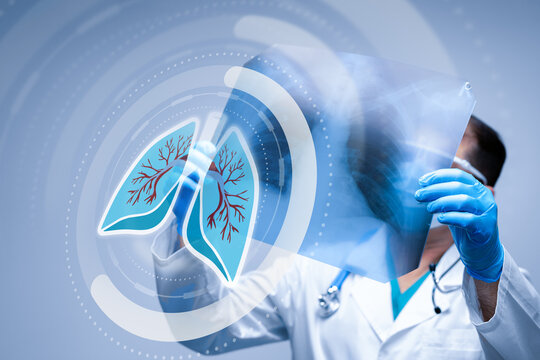 Doctor examining lung X-ray with digital overlay in modern medical facility