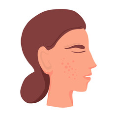 Female face profile with acne,  pimples vector illustration hand drawn