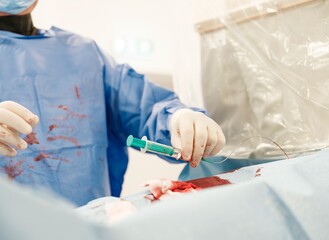 A medical professional performs an intricate procedure using advanced microspheres designed for targeted drug delivery in liver tumors, ensuring effective treatment and patient care