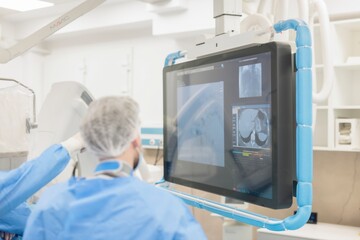 Medical professionals are collaborating in a clinical setting, utilizing advanced imaging technology to optimize treatments for patients with liver tumors using innovative drug-eluting microspheres