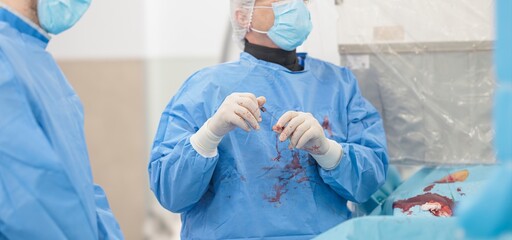 In a surgical environment, medical professionals discuss advanced microsphere technology designed for targeted liver cancer treatments, ensuring patient safety and improved recovery