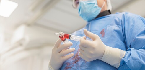 A healthcare professional in surgical attire prepares a syringe with resorbable microspheres designed for targeted drug release in treating liver tumors, showcasing advanced therapeutic options