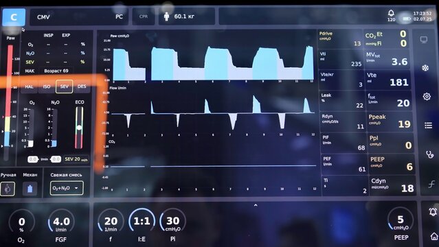 Medical ventilator screen showing patient's respiratory parameters. Media