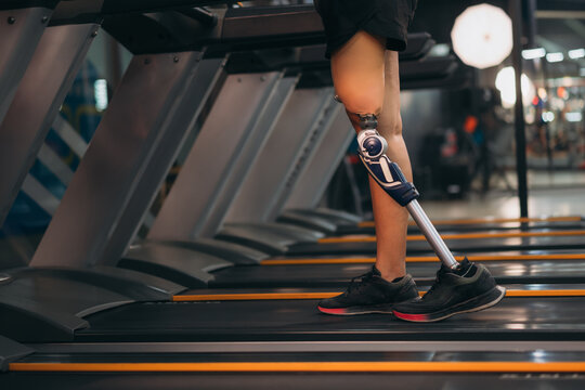 A motivated woman with a prosthetic leg walking on a treadmill in a modern gym, representing fitness, rehabilitation, and strength with a positive attitude towards an active healthy lifestyle.