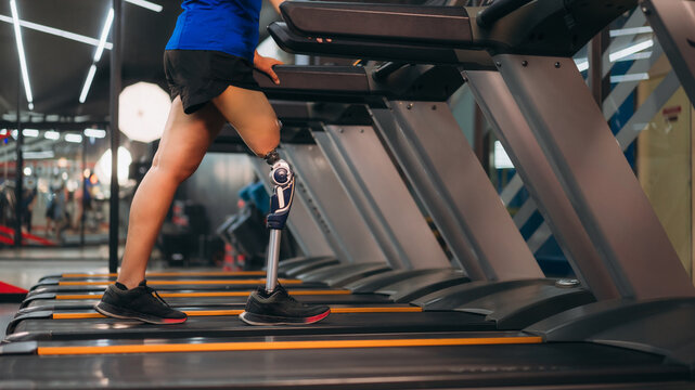 A motivated woman with a prosthetic leg walking on a treadmill in a modern gym, representing fitness, rehabilitation, and strength with a positive attitude towards an active healthy lifestyle.