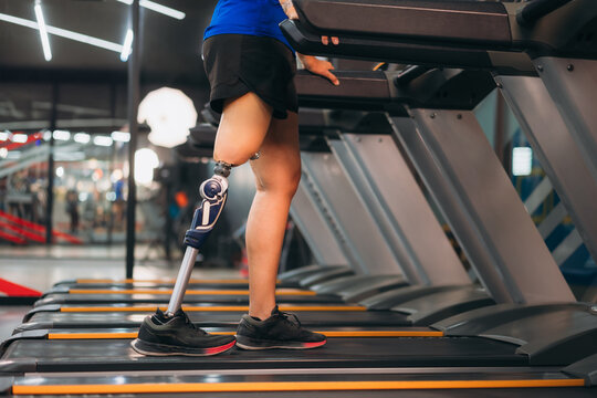 A motivated woman with a prosthetic leg walking on a treadmill in a modern gym, representing fitness, rehabilitation, and strength with a positive attitude towards an active healthy lifestyle.