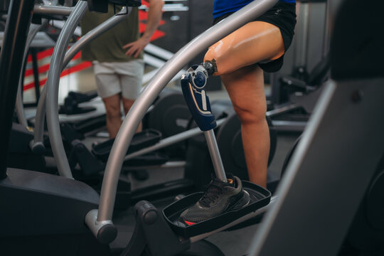 A motivated woman with a prosthetic leg walking on a treadmill in a modern gym, representing fitness, rehabilitation, and strength with a positive attitude towards an active healthy lifestyle.