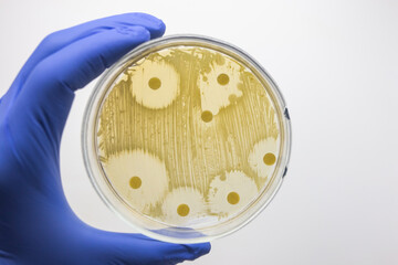 Open petri dish with round discs, round zones of no growth, effect of antibiotic on bacterial growth.