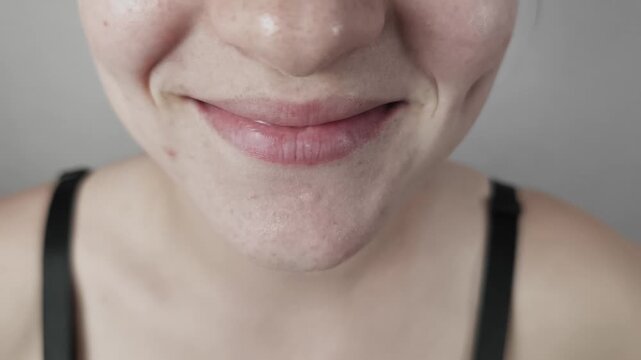 Macro front view of a female face with a gentle, closed-mouth smile highlighting her dimples. This shot details real skin texture, including visible pores, acne, and blemishes on her chin and cheeks.