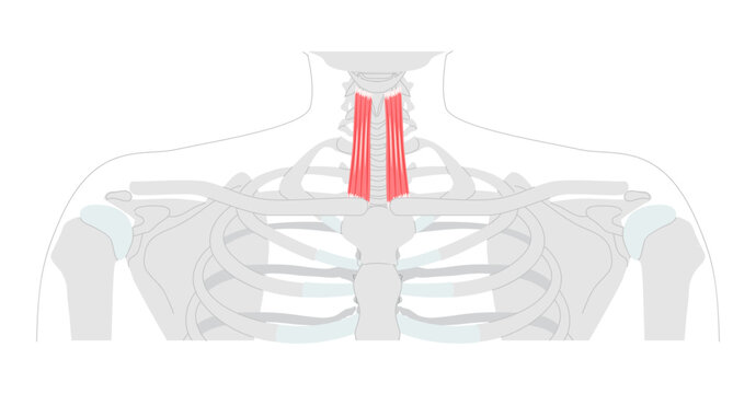 Sternothyroid - Infrahyoid muscle depicted in anatomy chart that depresses the thyroid cartilage, important for larynx movement and voice modulation, used in clinical and educational illustration