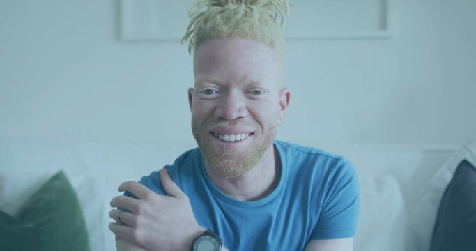 Smiling man with albinism wearing blue T-shirt sitting on white sofa at home, showing digital watch - Powered by Adobe