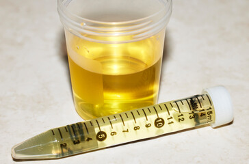 Urine Sample with Biohazard Bag