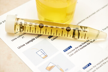 Urine Sample with Instructions