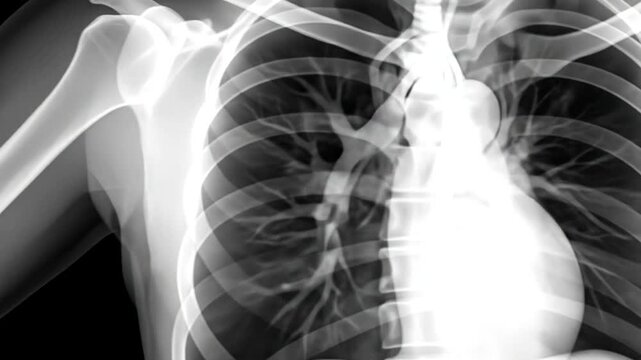 Human chest radiograph showing bones, lungs, and heart structures.