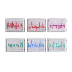 A medical illustration displaying various heart rate patterns