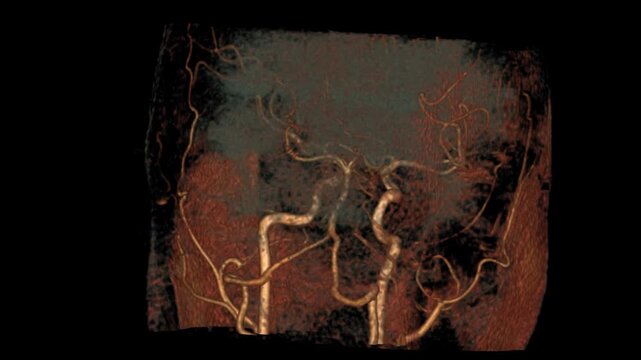 MRA brain VR scan showcasing intricate cerebral arteries and vascular networks in 3D. Ideal for neurological diagnosis, vascular assessment, and advanced medical visualization.