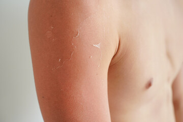 白背景の日焼けした若い男性の腕　クローズアップ