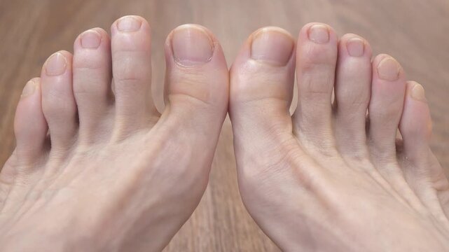 Beautiful male feet with uncut nails. Feet and toes of an adult man. Ten toes on two feet. Man wiggles his toes