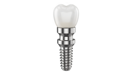 Dental implant close-up for healthy smile and dental care, showcasing modern dentistry and tooth restoration solutions