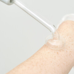 Clear glass device applying suction therapy on freckled arm for skin treatment process.