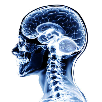 Radiant blue human brain and skull anatomy x ray profile isolated on transparent background