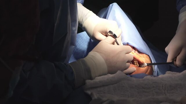 Dramatic low-light photograph showing a masked practitioner manipulating forceps inside a patients mouth while an assistant holds retractors. The composition centers on the hands, instruments and the 