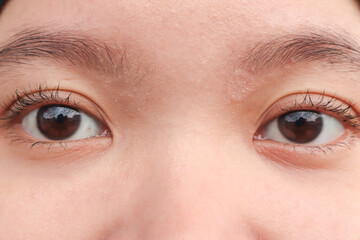 Macro photo of the right eye of a young Asian woman.