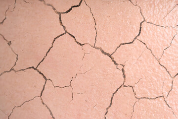 Dry skin presented as double exposure with cracked soil