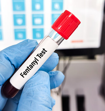Fentanyl, a highly potent synthetic piperidine opioid drug primarily used as an analgesic. It is 30 to 50 times more potent than heroin and 100 times than morphine.