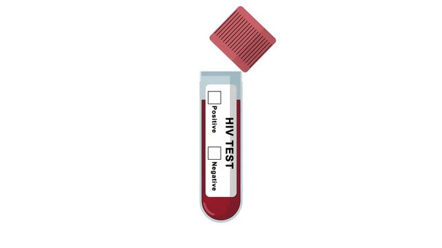 Animated HIV test tube showing a positive result with a red check mark. human immunodeficiency viruses or STD diagnosing test