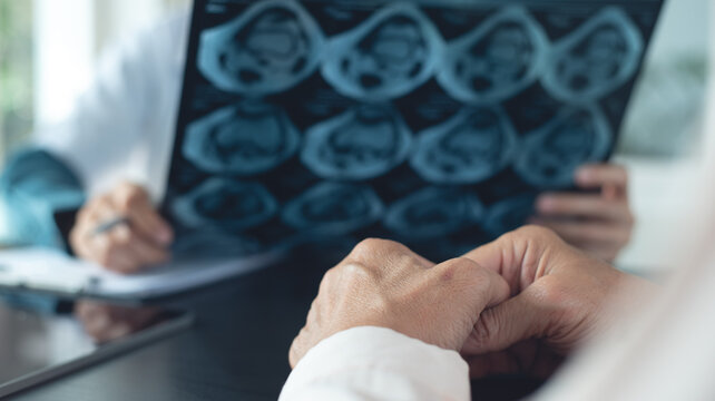 Orthopedist doctor examining knee bone MRI scan film of osteoarthritis in senior patient at hospital or medical clinic. healthcare and medicine concept.