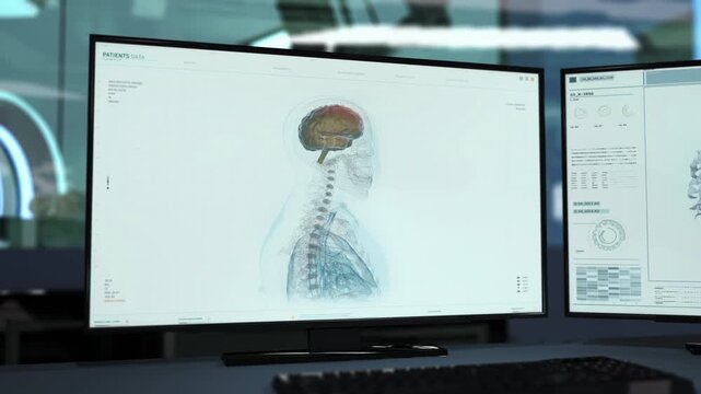 Innovative Medical System Human Anatomy Thorough Scanning Process. Brain Condition Examination By Digital Medical System. Patients Health Data Showcasing Via Medical System At A Modern Hospital.