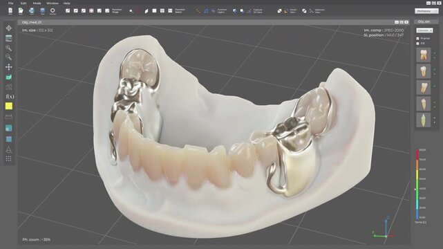 Medical Computer Interface Designing Dental Bridge Treatments For Patients Teeth. Applying Dentistry Treatment In Advanced Medical Interface. Medical Treatments Production. Program Interface. Jaw