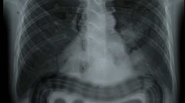 Revealing intricate details of a human chest cavity within a medical x-ray scan, showcasing skeletal structure and internal organs.