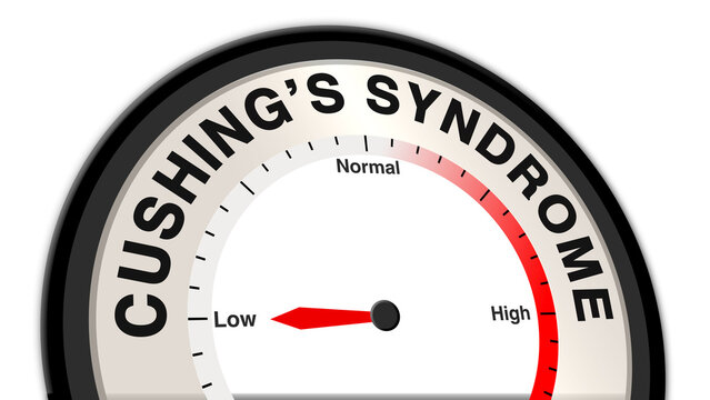 Cushing's syndrome at low severity shown on a barometer or tachometer, reflecting mild symptoms like slight weight gain, fatigue, and high blood pressure, with focus on monitoring and care